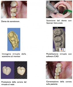 Fasi di scansione